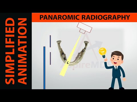 Animierte Prinzipien der Panoramaradiographie | OPG | Fokale Rinne | Dr. Bhaumik Joshi | ASPIRE MDS