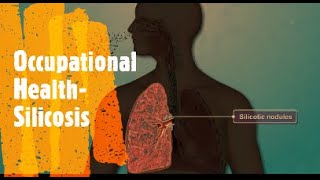 #Silicosis Basic1 #Pneumoconiosis #Lung #OccupationalHealth #Hospital Management