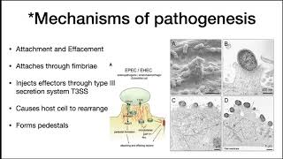 E coli infection in humans