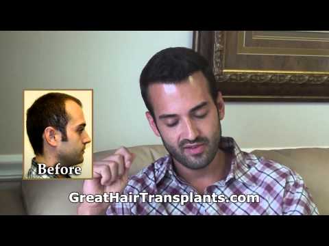 Update on Ryan Hair Transplant Video