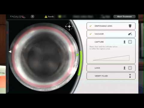 George Waring IV, MD FACS 1st Optimedica laser assisted cataract surgery SC