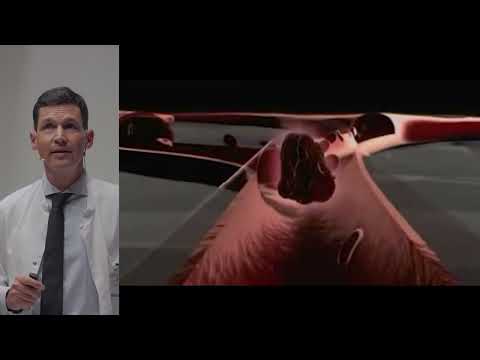 Mehr Wissen: Herzrhythmusstörungen – Wenn das Herz aus dem Takt gerät