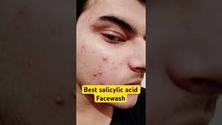 Download lagu Best salicylic acid face wash for men & women | salicylic acid cleanser for oily skin #shorts mp3 Download lagu Best salicylic acid face wash for men & women | salicylic acid cleanser for oily skin #shorts mp3