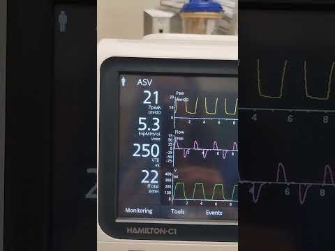 Hamilton C-1 ASV Mode