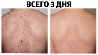 Ссылка