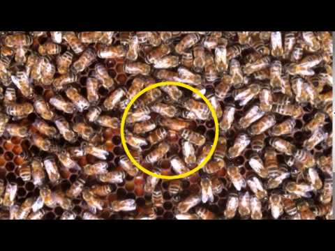 Spasmo dei muscoli nella regione toracica Ortesi ginocchio negozio