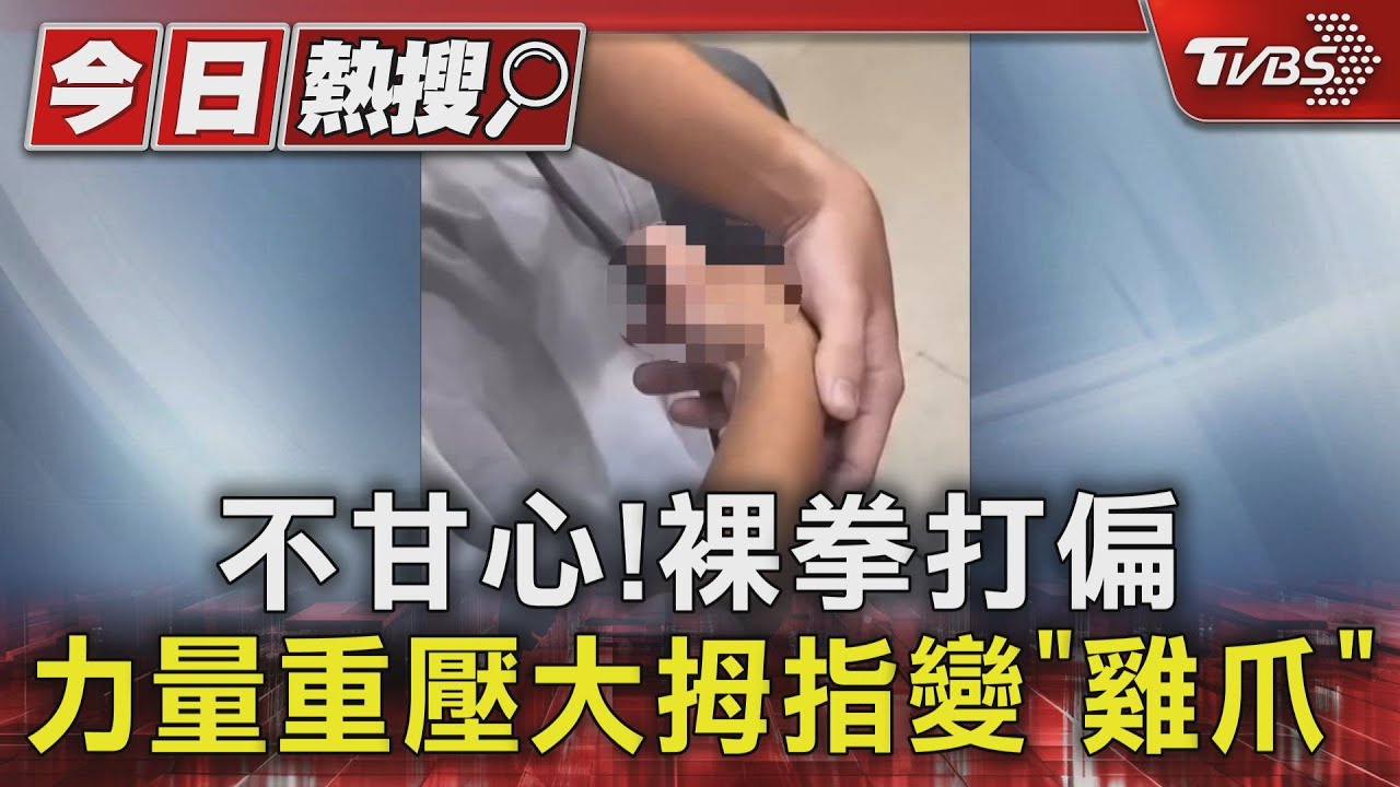 不甘心!裸拳打偏 力量重壓大拇指變「雞爪」