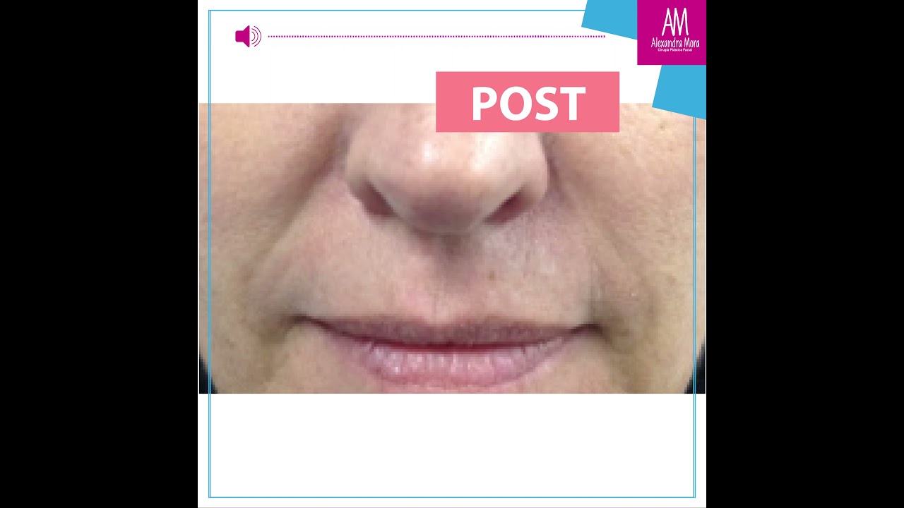 Alexandra Mora Hernandez-151