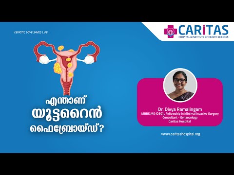 What is a uterine fibroid?