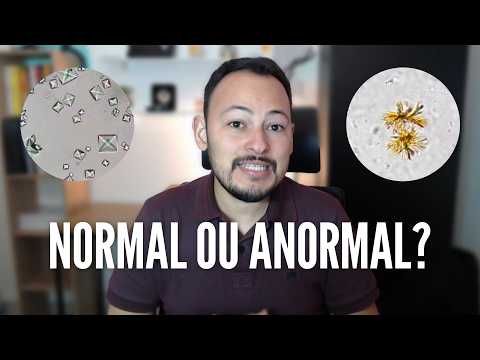 Principais cristais encontrados na urina