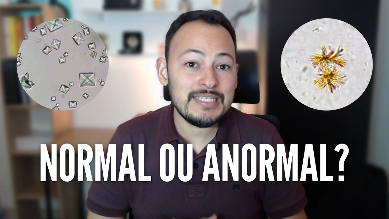 Principais cristais encontrados na urina