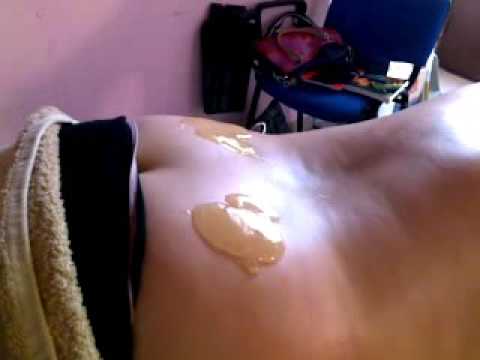 Was bei Osteochondrose im Bein zu tun Ich hatte den Arm aus der Fassung
