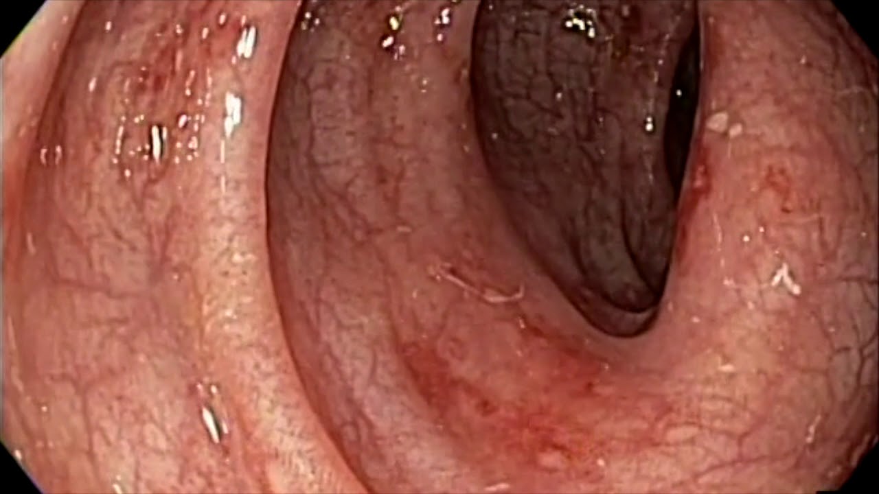 Adriana Fabiola Romano Munive-27