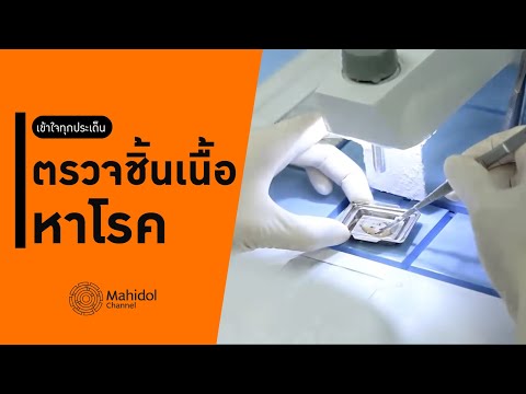 ขั้นตอน