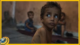 Սով, համաճարակ, դիեր ու անմարդկային տառապանքներ. ՄԱԿ-ի հավաքը Թրամփը համարել է «գովազդային հնարք»