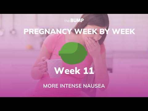 Pregnancy Week 11 | More Intense Nausea | Pregnancy Week By Week