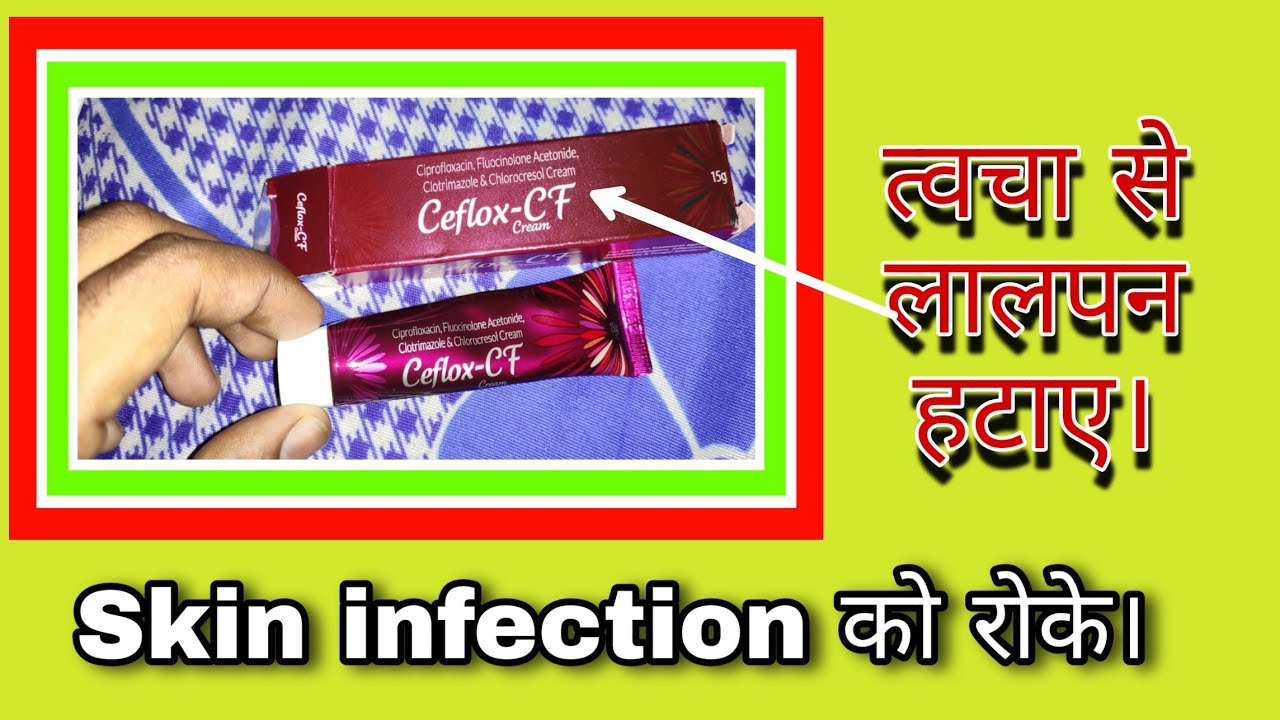 Watch video Ceflox cf cream Review | Redness problem | Skin Infection | Antifungal Antibacterial Problem Now Ceflox cf cream Review | Redness problem | Skin Infection | Antifungal Antibacterial Problem