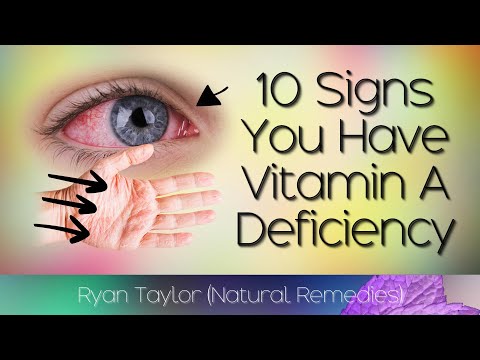 10 Common Signs of Vitamin A Deficiency