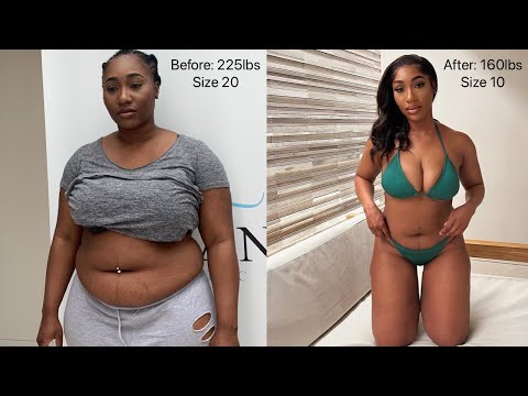 HOW I WENT FROM SIZE 20 to SIZE 10: GASTRIC SLEEVE UPDATE + Q&A 3 YEARS POST OP ✨