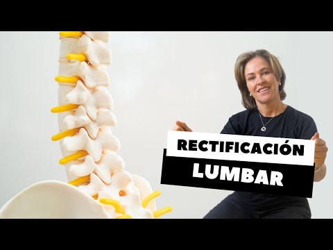 RECTIFICACIÓN LUMBAR