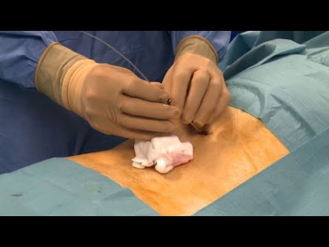 Dolorante dolore ai lati nella parte bassa della schiena durante la gravidanza Lasse di rotazione di movimento delle articolazioni