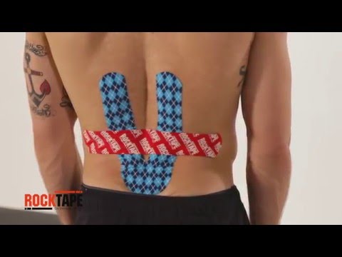 Схема тейпирования спины при болях в пояснице