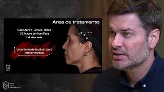 Bioestimuladores de Colágeno Pontos e modo de aplicação