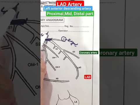 LAD coronary artery l Proximal,mid, distal part l #angiography #coronary #shorts PART-1