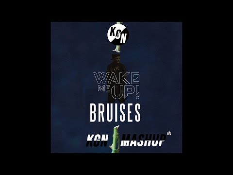Avicii x Lewis Capaldi - Wake Me Up x Bruises (KGN Mashup)