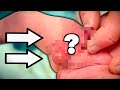 HELP SOMETHING S WRONG WITH MY BABY S PENIS Hypospadias Dr Paul