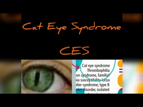 Cat Eye Syndrome (CES) chromosome 22 aberration /(In English)