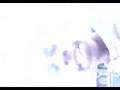 F2d