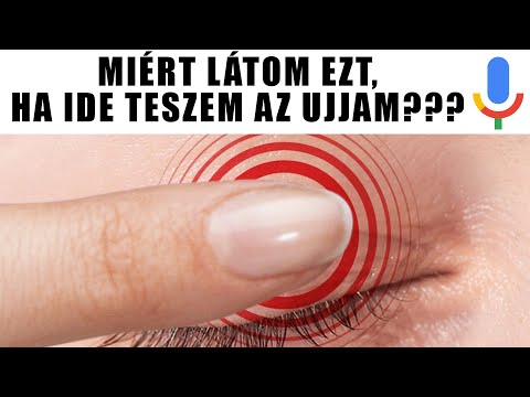 hogyan kenheti be a lábát visszérrel