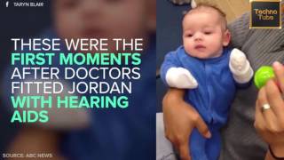 This Baby Can Now Hear!! Adorable Reactions