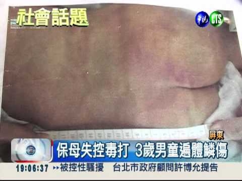 男女保母失控狂打 3歲男童陷昏迷