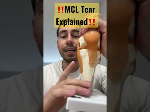 MCL-Riss erklärt #shorts