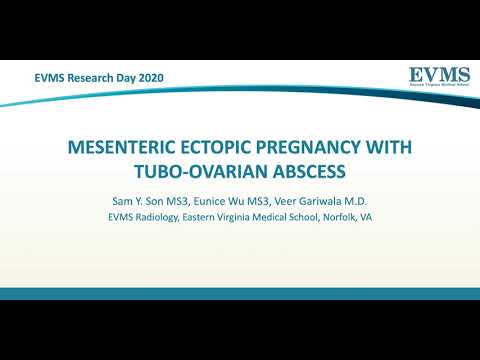Thumbnail image of video presentation for Mesenteric Ectopic Pregnancy with Tubo-ovarian Abscess