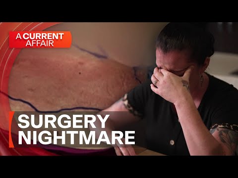 How a mum's dream body surgery turned into a nightmare | A Current Affair