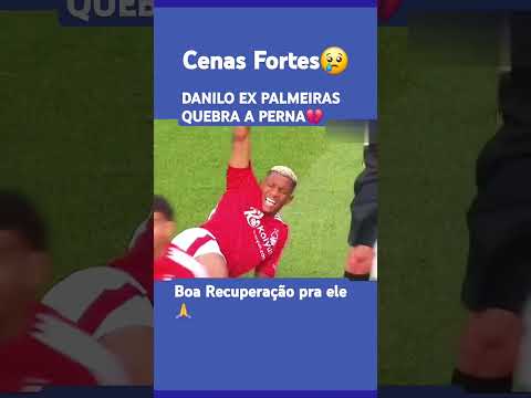 Danilo quebra a perna em primeiro jogo da temporada #shorts #futebol