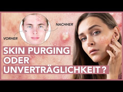 Erstverschlimmerung – Skin Purging für reine Haut