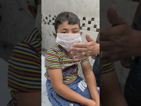 case 344 startle disease, hyperekplexia, dr zuhair, encephalitis, Tay-saches, coffin Lowery syndrom