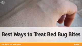 Best Ways to Treat Bed Bug Bites
