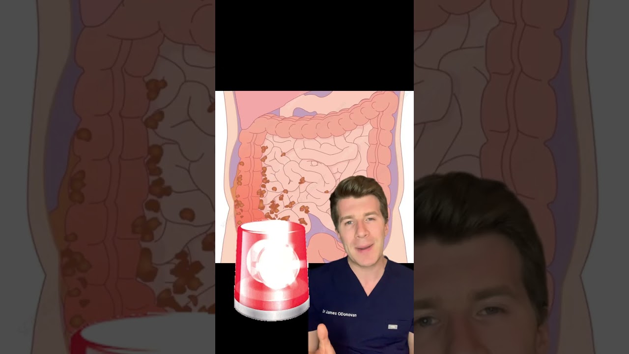 What is an appendix?