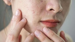 Skin Infections  A Comprehensive Treatment Guide