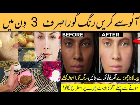 Potato facial mask for Skin whitening | It removed my dark spots in 3 DAYS