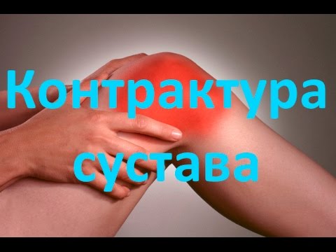 Гиалуроновая кислота инъекции при артрозе коленных суставов Куда наклеить перцовый пластырь при остеохондрозе