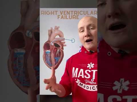 Pathophysiology of Right Ventricular Failure
