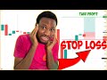 PRICE ACTION Best Way To Set Your STOP LOSS