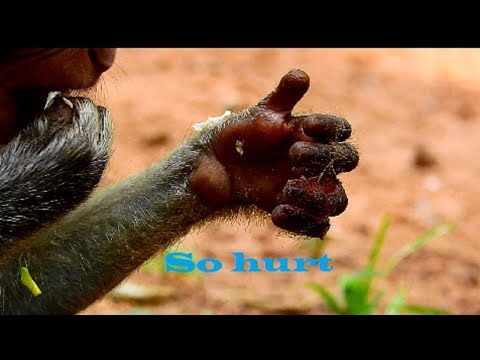 million sad !!! Julina deeply worry about injure, She look so unbelievable, Very pity baby 1087