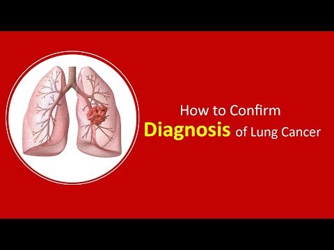 Lung Cancer Diagnosis